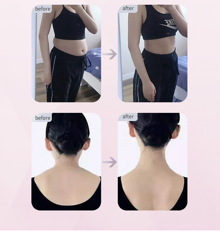 body contouring machine