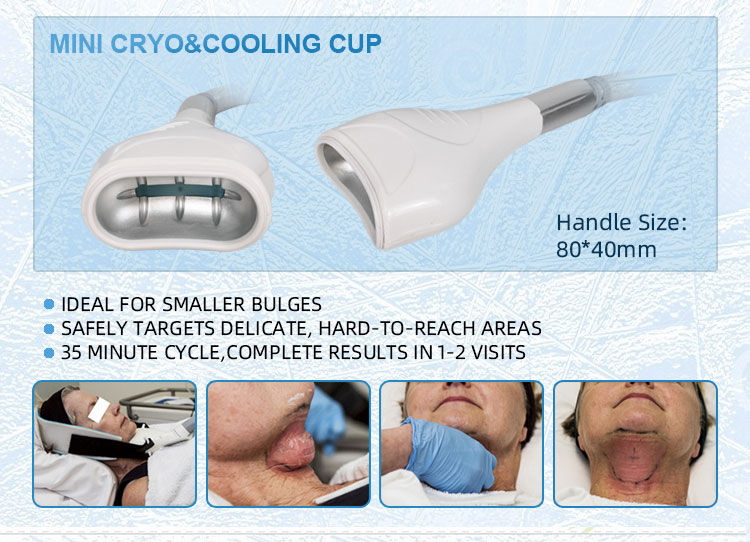 Cryotherapy Fat Freezing Equipment