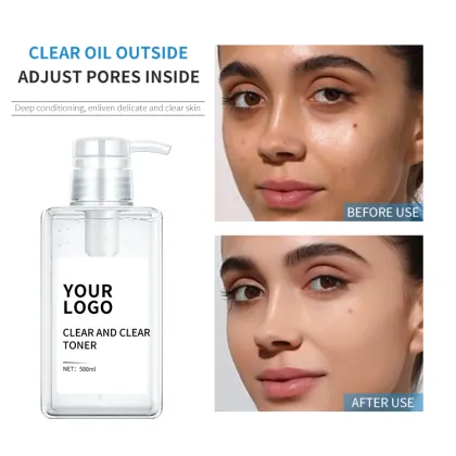 Water-Oil Balance Oil Control Acne Removal Toner