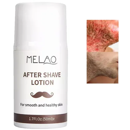 Men Natural Organic After Shave Beard Care Lotion