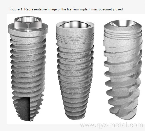 Implanted titanium alloy screw for surgical and dental