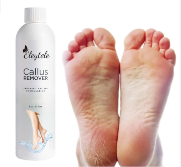 Professional Foot Care: Tea Tree Oil Callus Remover & Exfoliating Gel