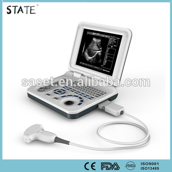 b/w digital pc notebook ultrasound machine price