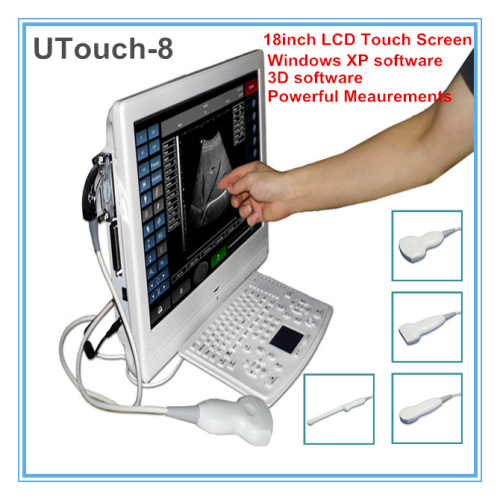 Touch Screen LCD Digital Ultrasound Scanner