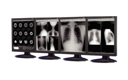 Anti-reflective Medical Grade Displays Used In Medical Imaging Equipment