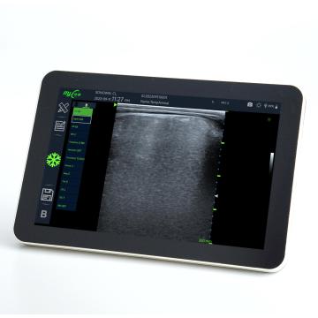 cow ultrasound machine for sale with L180 3.5MHz Backfat probe
