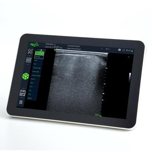 Fast Scan OPU big back fat