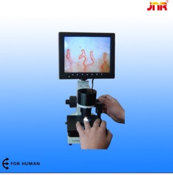 Professional Blood Capillary Color Microcirculation Microscope