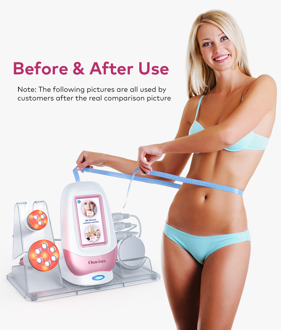 Omeina ultrasonic cavitation machine