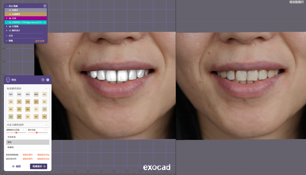 DentalCADScreens