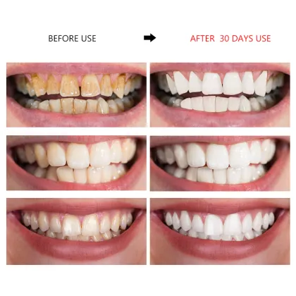 2022 New Technology Toothpaste: Whitening Mousse Foam