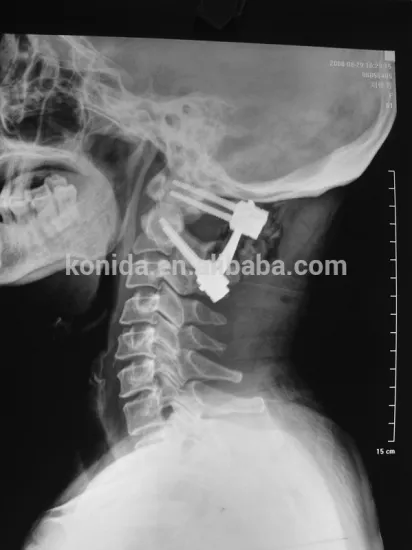 fuji 8*10inch xray blue film for drypix printers