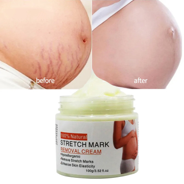 Crema di potenziamento dell'elasticità della pelle all'ingrosso 100 g