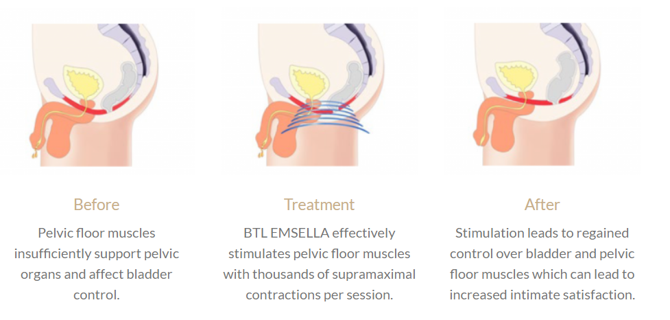Ems Chair Women Exercise Muscle Pelvic Floor Muscle Repair Buttock Lift EMS stimulate Chair
