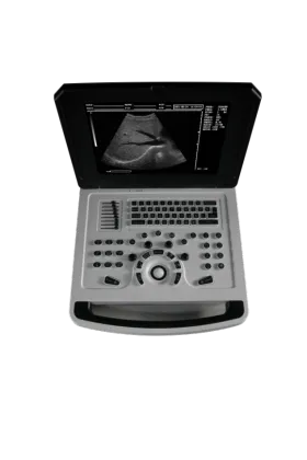 Notebook Full-digital Ultrasound Scanner Machine