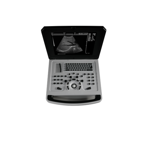Black and White Ultrasound Scanner Notebook Full-digital Ultrasound Scanner Machine Manufactory
