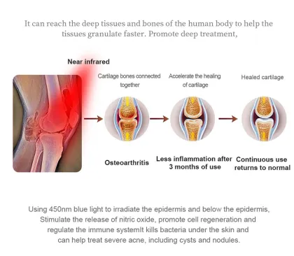Full Body Davinci Red Light Bed