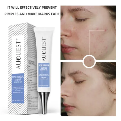 Differin Gel: Hot Selling Organic Anti-Acne Scar, Spot Repair & Face Whitening Cream