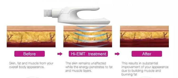 Theory EMS Body Slimming Machine