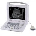 Draagbare Laptop Ultrasound Scanner Ultrasound Machine Prijs