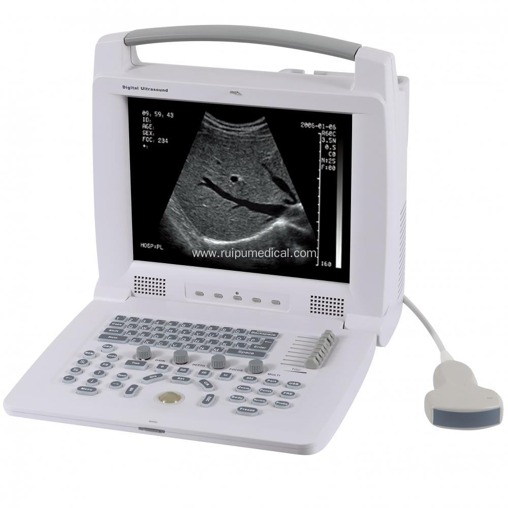 Portable Laptop Ultrasound Scanner Ultrasound Machine Price