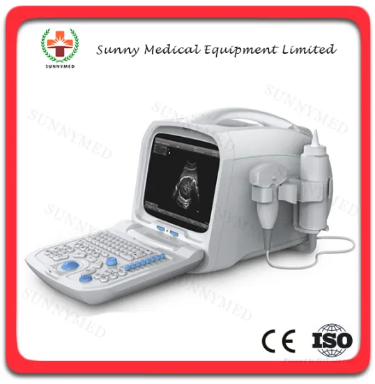 SY-A002 All-digital hospital portable ultrasound Diagnosing Equipment
