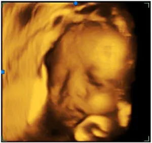 Laptop Full digital equipo de ultrasonido 4d sonography echographe portable