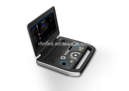 Ecografos/Echocardiography/Ultrasound better than Mindray Ultrasound