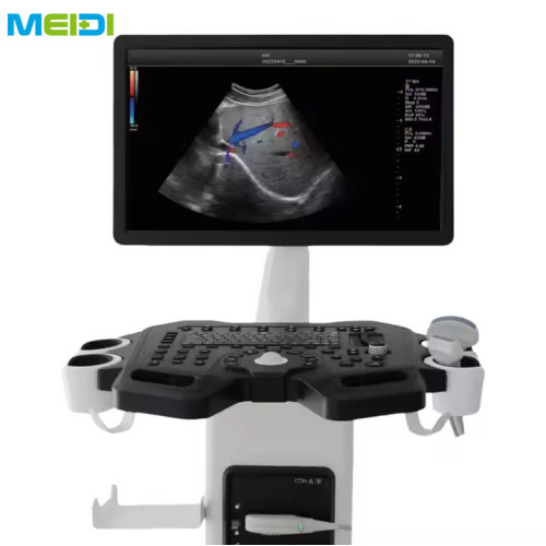 Trolley Color Doppler Ultrasound Scanner