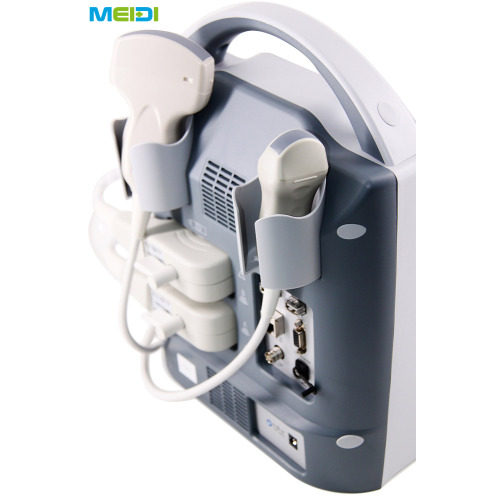 Full Digital B Mode Ultrasound Scanner