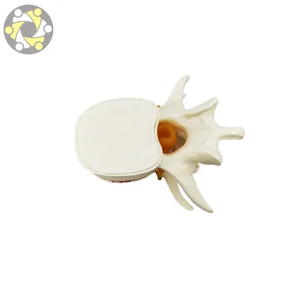 Vertebral Spine Simulator for Lumbar Disc Herniation Medical Science Model