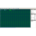 12 canais eletrocardiógrafo da máquina do ECG