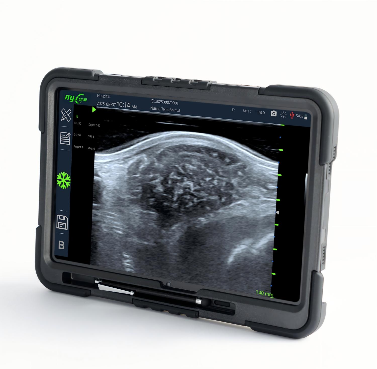 are there portable ultrasound machines