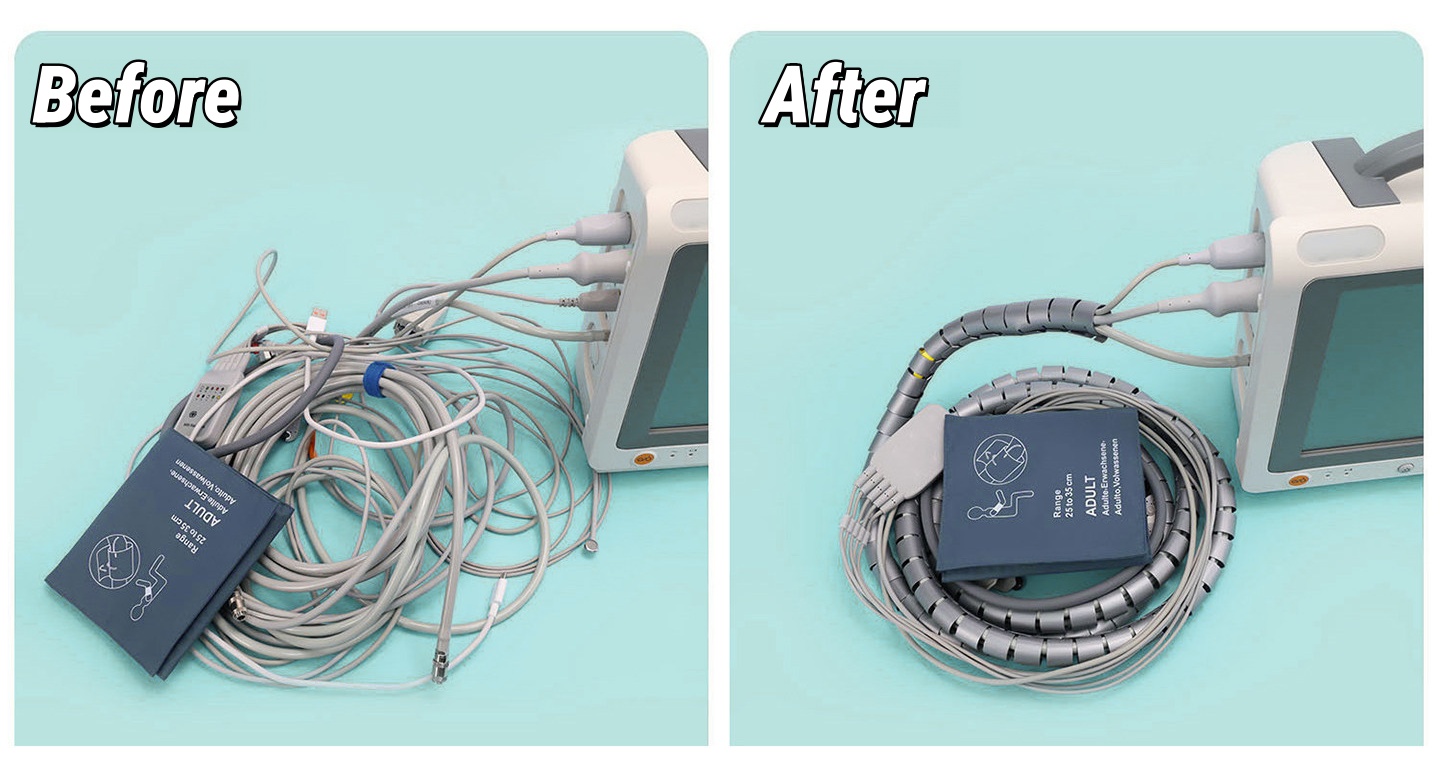 medical wire management