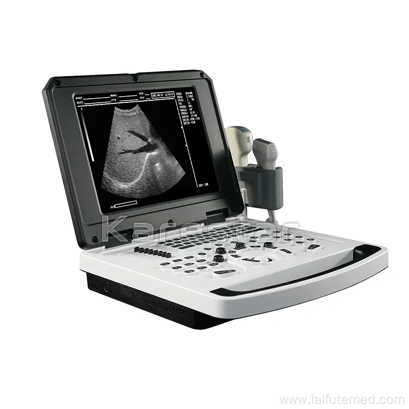 Portable B/W Ultrasound Diagnostic System