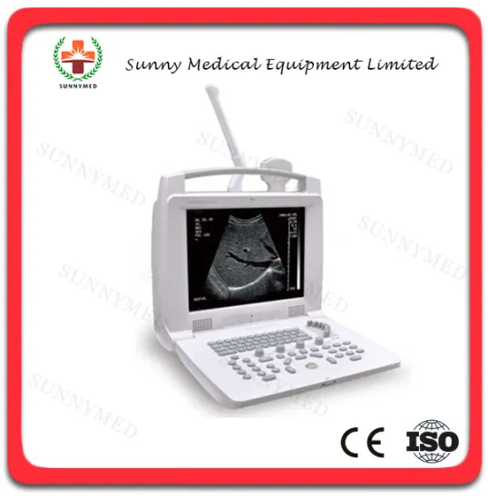 SY-A005 Digital Portable B Ultrasound Scanner