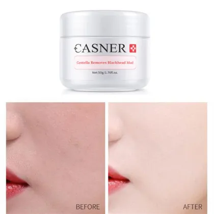 blackhead acne remover deep cleansing pore mud mask