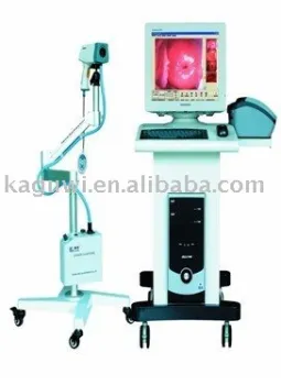 Colposcope Digital Imaging System