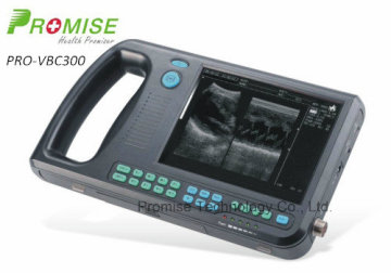 Digital Palmtop Vet Ultrasound (PRO-VBC300)