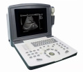 Scanner B-UltraSound portatile con sonde di rimorchio