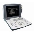 Tragbarer B-Ultrasound-Scanner mit Schleppsonden