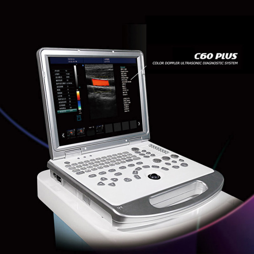 4d color doppler ultrasound scanner machine