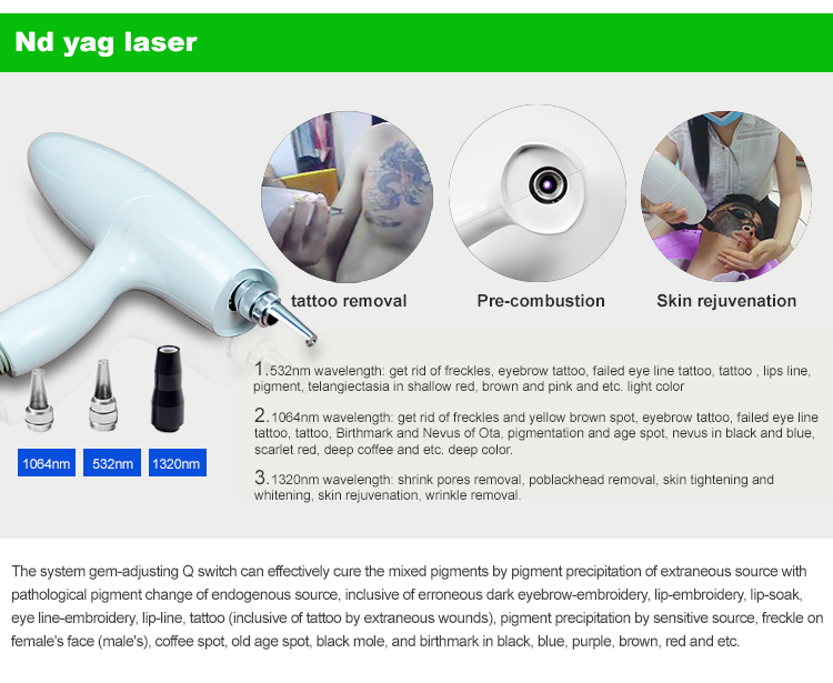 laser hair removal handset
