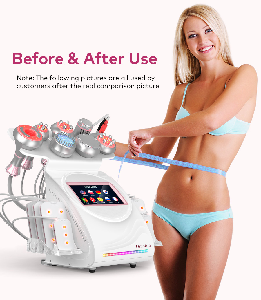 Omeina cavitation laser lipo machine