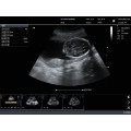 KPC-3C Convex Palm Doppler ультрагукавая сістэма