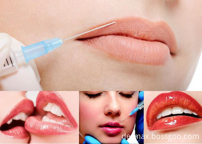 lip filler (2)