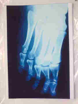 Medical image film,image film,dry film,XILONGfilm,medical instrument