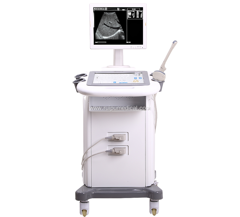 B/W Trolley Ultrasound Scanner Good Price Ultrasound Machine