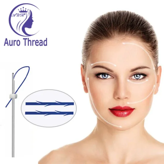 Minimally Invasive Face Lifting Mono Screw Thread Pdo