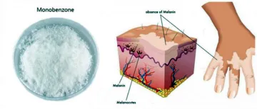 supply high quality pure monobenzone Powder